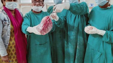 Photo of सरकारी अस्पताल बाराबंकी में 10 किलों का ओवेरियन सिस्ट निकाला चिकित्सकों ने